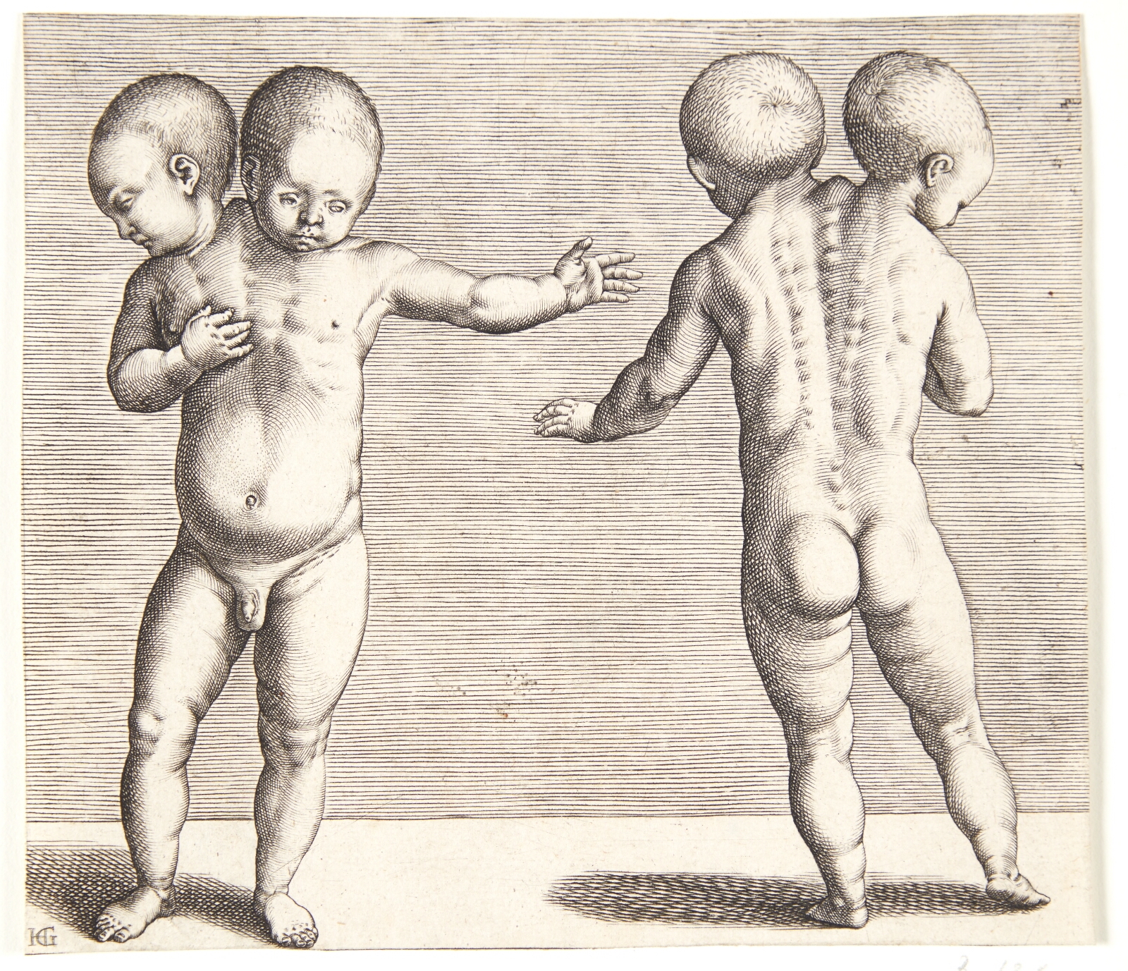 Hendrick Goltzius, Et vanskabt barn med to hoveder